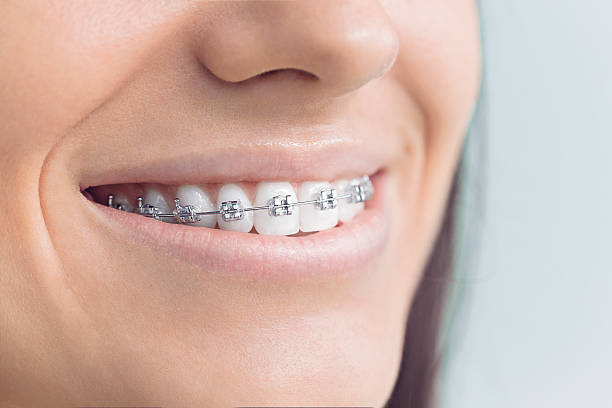 Dental Bonding in Deatsville, AL